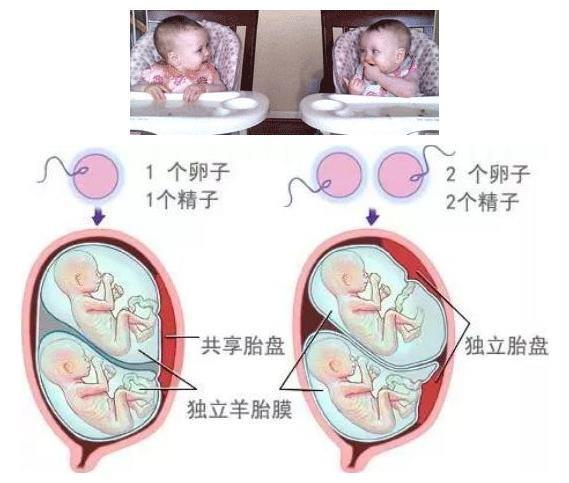 包生男孩双胞胎_包生男孩双胞胎的成长故事